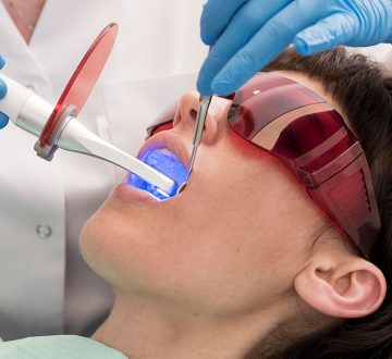 Why Choose Professional Teeth Whitening in Rockwall?